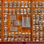 O Museu Mütter da Filadélfia abriga o cérebro de Einstein e outras curiosidades